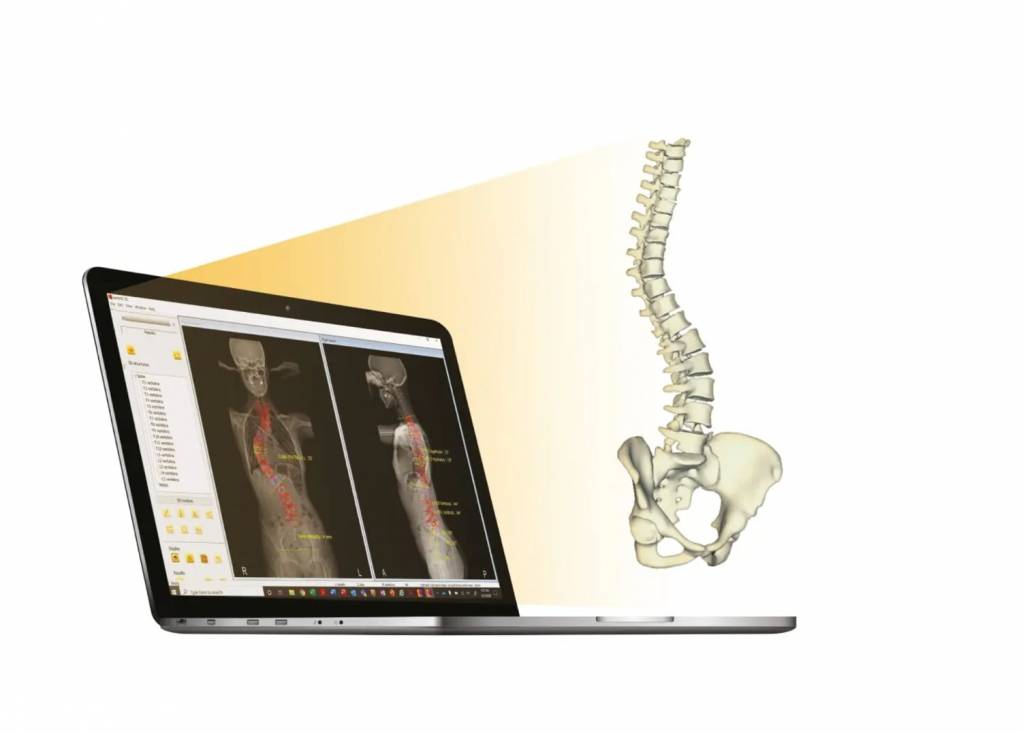 EOS Imaging