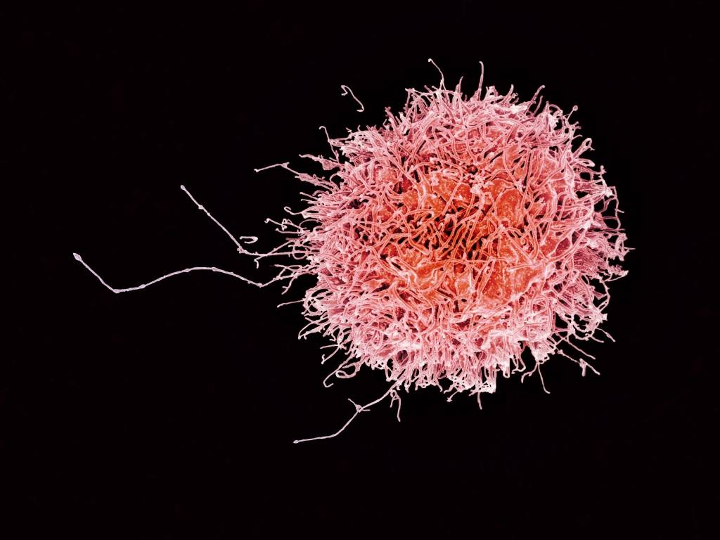 Cellule tueuse (natural killer) d'un donneur humain.