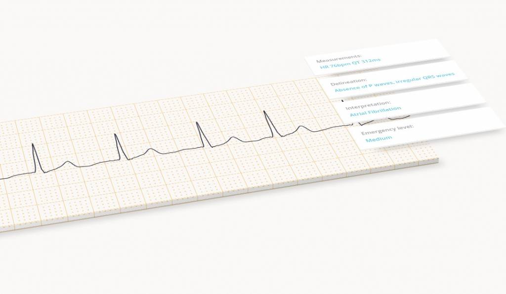 Cardiologs