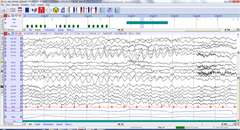 © Micromed