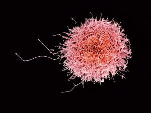Cellule tueuse (natural killer) d'un donneur humain.