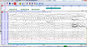 © Micromed